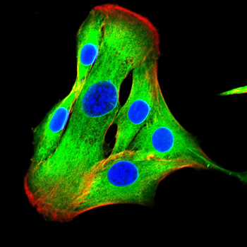 HLA-F Antibody