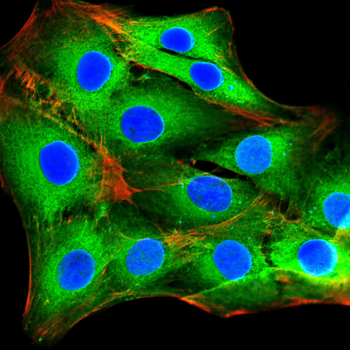 KLK2 Antibody