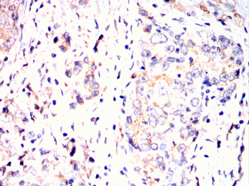 KLK2 Antibody