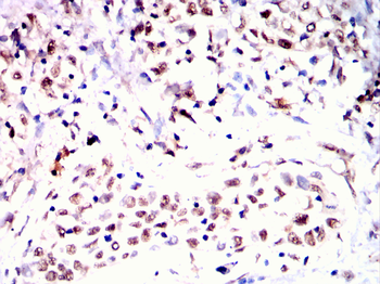 NDC80 Antibody