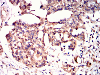 NDC80 Antibody