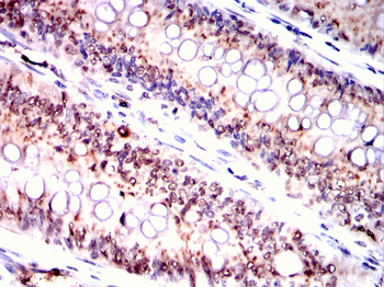 NDC80 Antibody