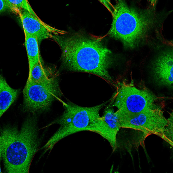 AKT2 Antibody