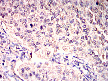 AKT2 Antibody