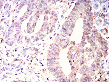 AKT2 Antibody