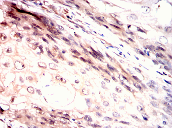 AKT2 Antibody