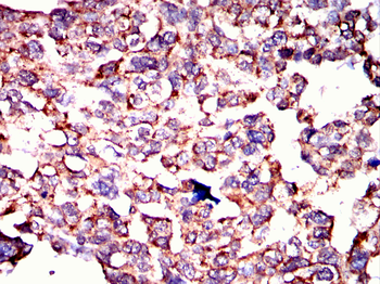 BDH1 Antibody