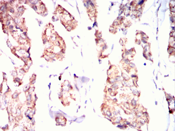 BDH1 Antibody