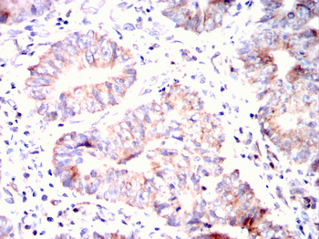BDH1 Antibody
