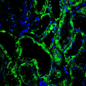 BDH1 Antibody