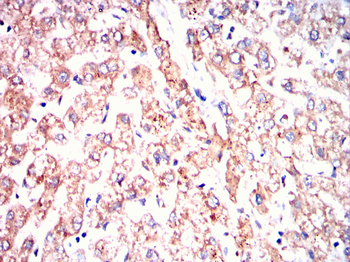 BDH1 Antibody