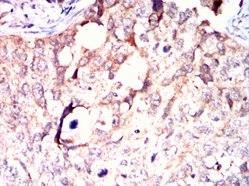 BDH1 Antibody