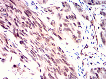 TCF3 Antibody