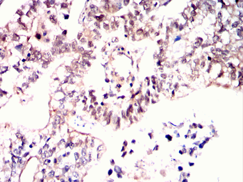 TCF3 Antibody