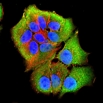 STAT5B Antibody