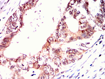 STAT5B Antibody