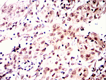 STAT5B Antibody