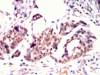 STAT5B Antibody