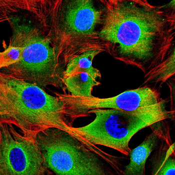 ETFA Antibody