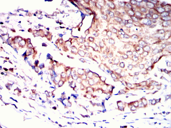 ETFA Antibody