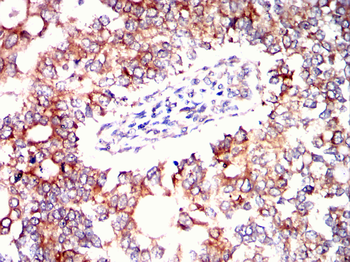 ETFA Antibody