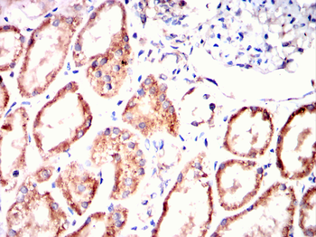 ETFA Antibody