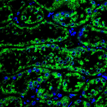 ETFA Antibody