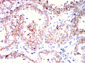 ETFA Antibody