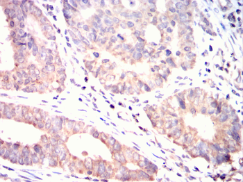 TRIB2 Antibody