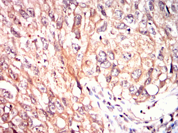 TRIB2 Antibody