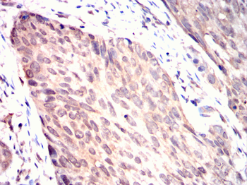 TRIB2 Antibody