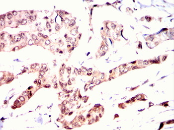 CDC25C Antibody