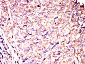 PTH1R Antibody
