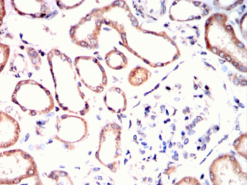 PTH1R Antibody
