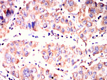 PTH1R Antibody