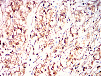 PTH1R Antibody