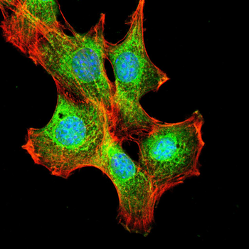 ERBB2 Antibody
