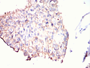 ERBB2 Antibody