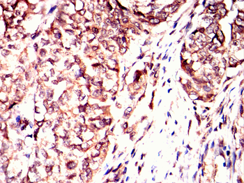 STK11 Antibody