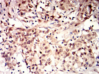 STK11 Antibody