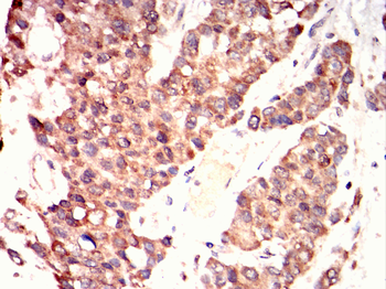 STK11 Antibody
