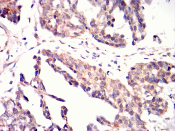 STK11 Antibody