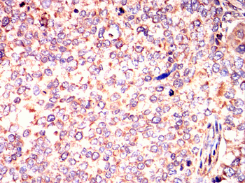 CTCF Antibody