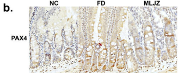 PAX4 Antibody