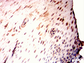 PAX4 Antibody