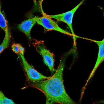 NR3C1 Antibody