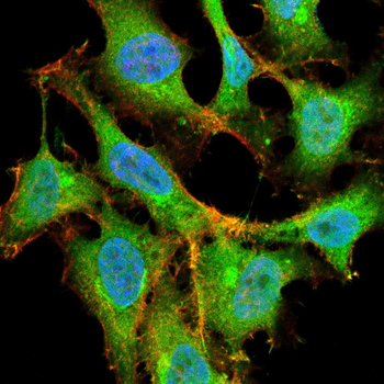 ATF2 Antibody