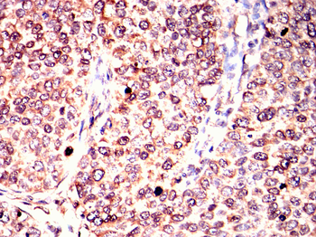ATF2 Antibody