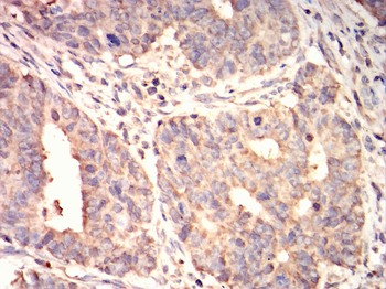 ATF2 Antibody
