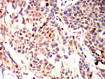 ATF2 Antibody